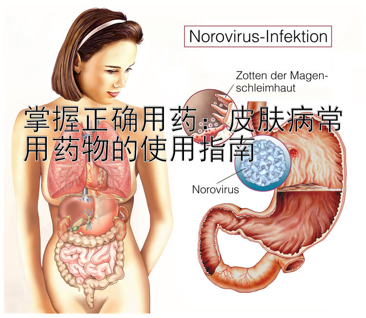 掌握正确用药：皮肤病常用药物的使用指南